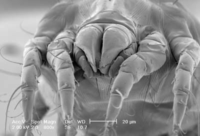 House dust mite Environmental Control of House Dust Mites Homepage