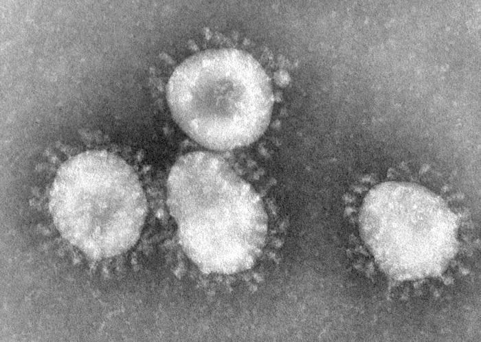Human coronavirus NL63