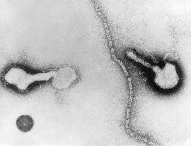 Human parainfluenza viruses