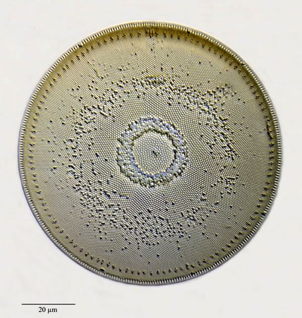 Hyalodiscus Phycokey Hyalodiscus images