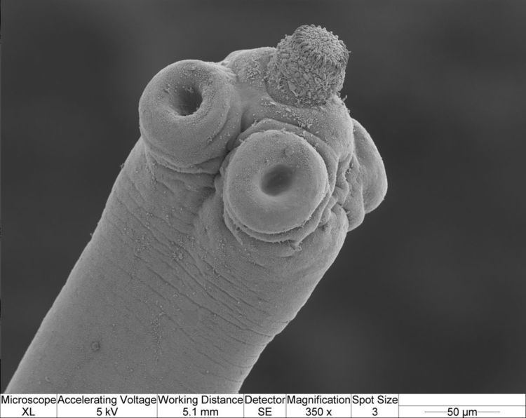 Hymenolepis microstoma httpsuploadwikimediaorgwikipediacommonsthu