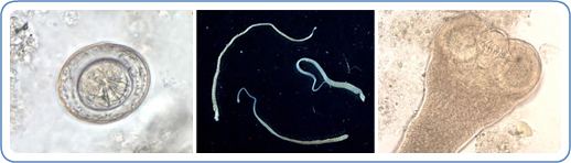 Hymenolepis (tapeworm) CDC Hymenolepis