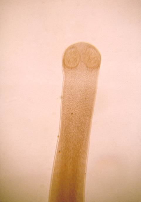 Hymenolepis (tapeworm) Hymenolepis tapeworm Wikipedia