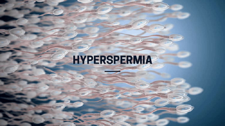 Hyperspermia Hyperspermia