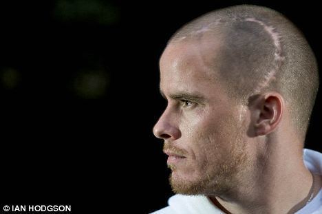 Iain Hume Iain Hume Scar pictures on my phone are a reminder of how
