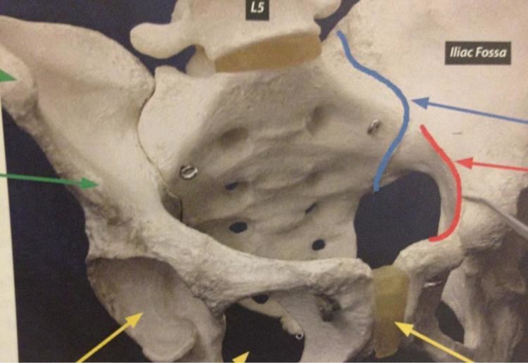 Anteroposterior view of the pelvis. The red arrow indicated the iliopectineal line