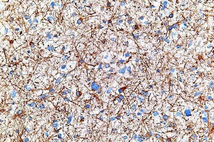 Immunostaining