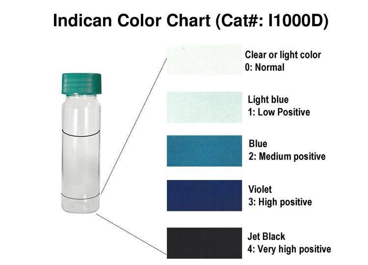 Indican Indican Obermeyer Test Kit