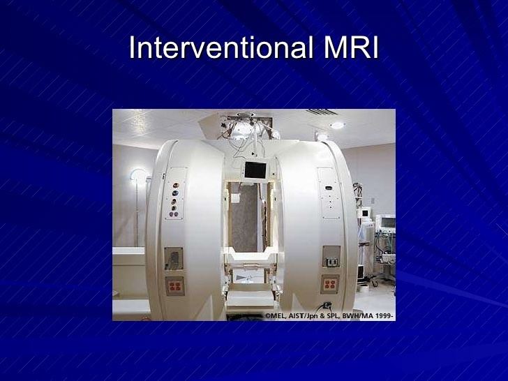 Interventional magnetic resonance imaging Radiologic evaluation of intracranial tumors2