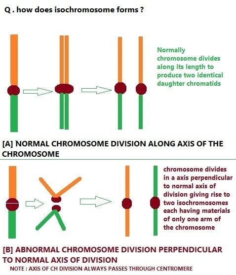 This photo shows how Isochromosome forms in normal chromosome division along the axis of the chromosome and abnormal chromosome division perpendicular to the normal axis of division