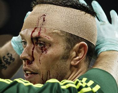 Jack Jewsbury Portland Timbers Jack Jewsbury to have stitches removed