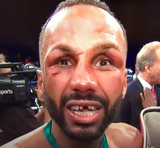 James DeGale i1mirrorcoukincomingarticle9625563eceALTERN