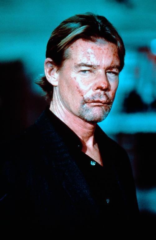 Jan-Michael Vincent with a mustache, beard, and stitches on his face while wearing a black long sleeve