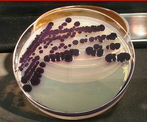 Janthinobacterium lividum schaechterasmblogorga6a00d8341c5e1453ef01156e