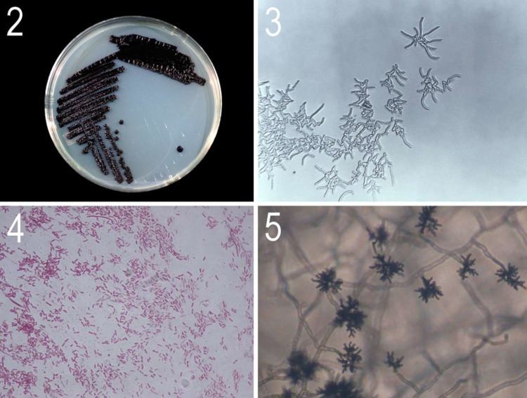 Janthinobacterium lividum Figs 25 Bacteria and Fungi 2 Janthinobacterium lividum 3
