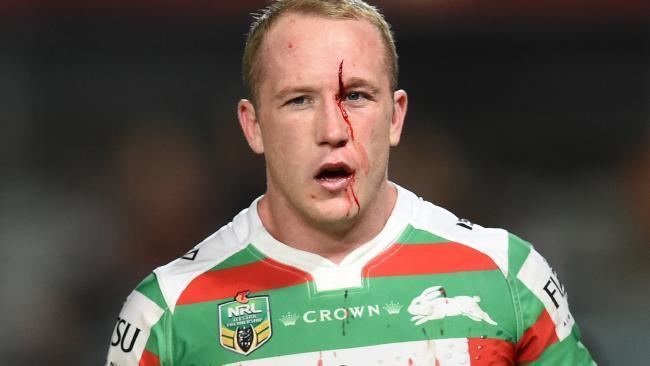 Jason Clark (rugby league) Jason Clark NRL Rabbitohs forwards viral head cut injury video