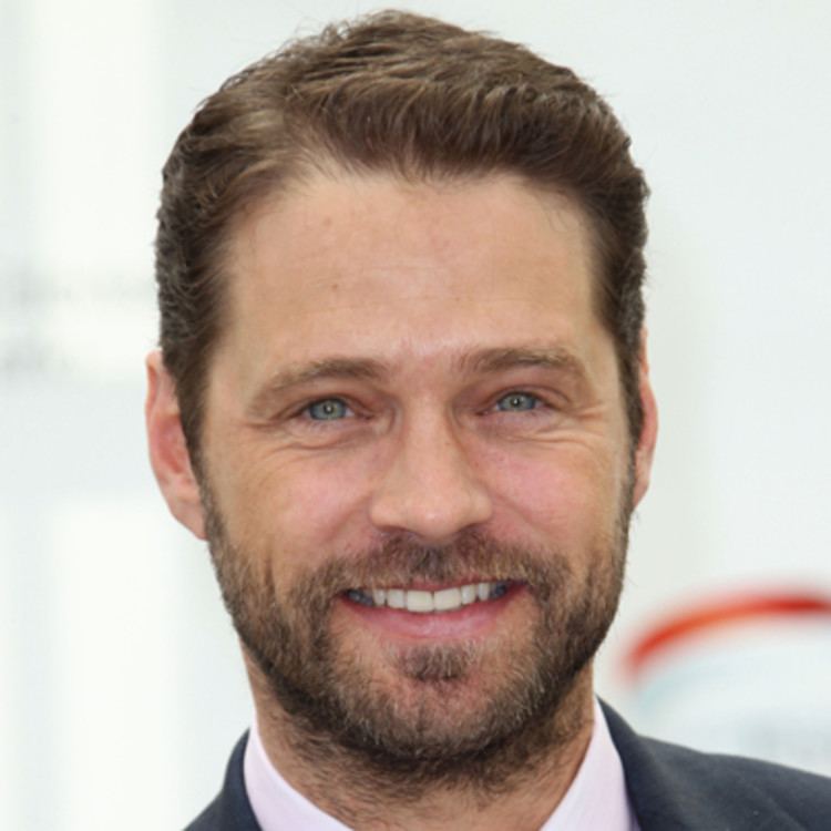 jason priestley accident face