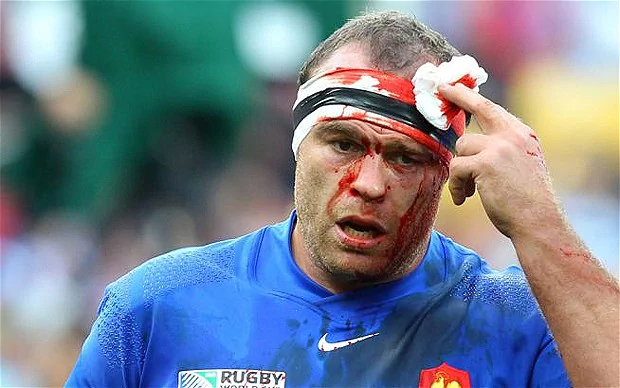 Jean-Baptiste Poux Rugby World Cup 2011 Tonga v France in pictures Telegraph