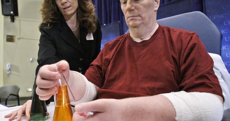 Jeff Kepner First American to get double hand transplant Jeff Kepner wants
