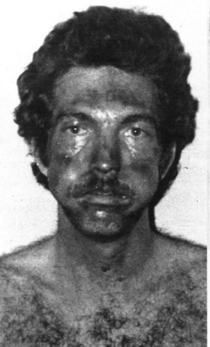 Jeffrey Rignall Jeff Rignall as he appeared after escaping John Wayne Gacy He was