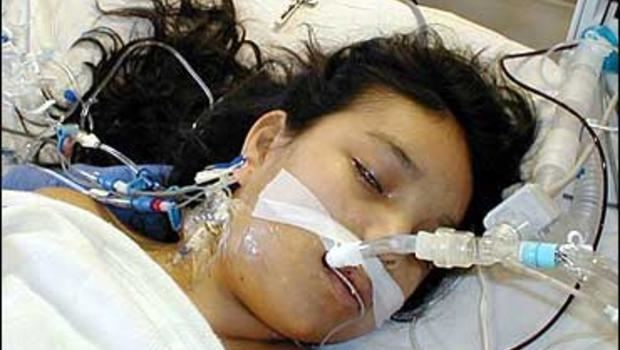 Jesica Santillan Botched Transplant Teen Dies CBS News