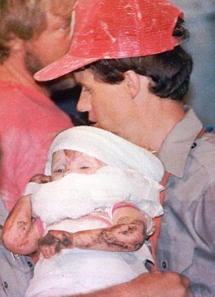 Baby Jessica after being rescued from the well