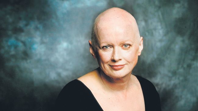 Jill Baker on her no hair look after her battle with cancer
