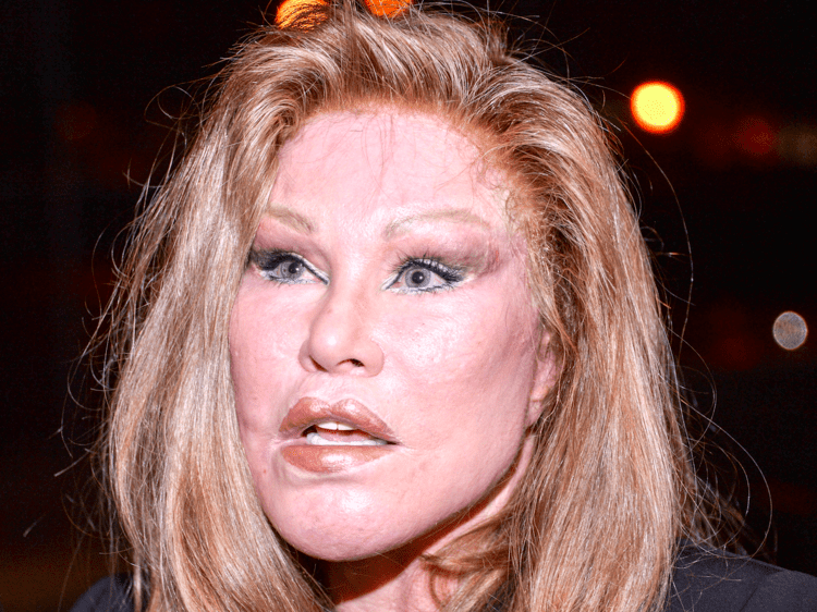 Jocelyn Wildenstein Billionaire socialite Jocelyn Wildenstein bio pics Lloyd Klein