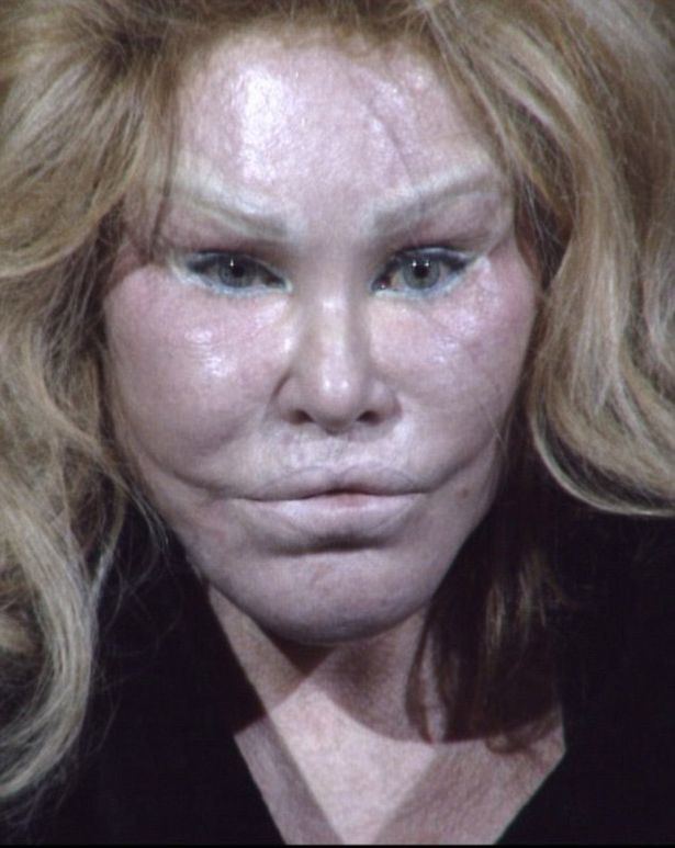 Jocelyn Wildenstein i2mirrorcoukincomingarticle9420167eceALTERN