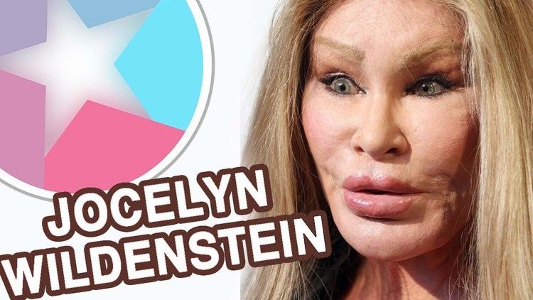 Jocelyn Wildenstein Jocelyn Wildenstein Then and Now YouTube