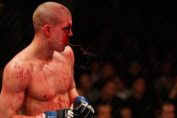 Joe Lauzon UFC Joe Lauzon Posts Photo of Shredded Face After UFC 155