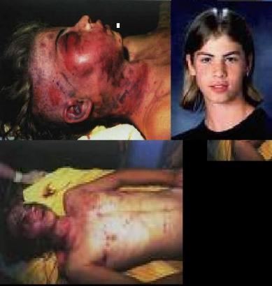 On the left, John Hron with bruises on his face and body while on the right, he is smiling and wearing a black t-shirt