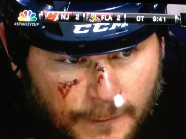 John Madden (ice hockey) Panthers39 John Madden Smashes Face During Collision With