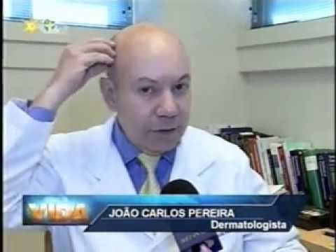 João Carlos Pereira Jornal da Vida 080513Dr Joo Carlos PereiraTransplante capilar