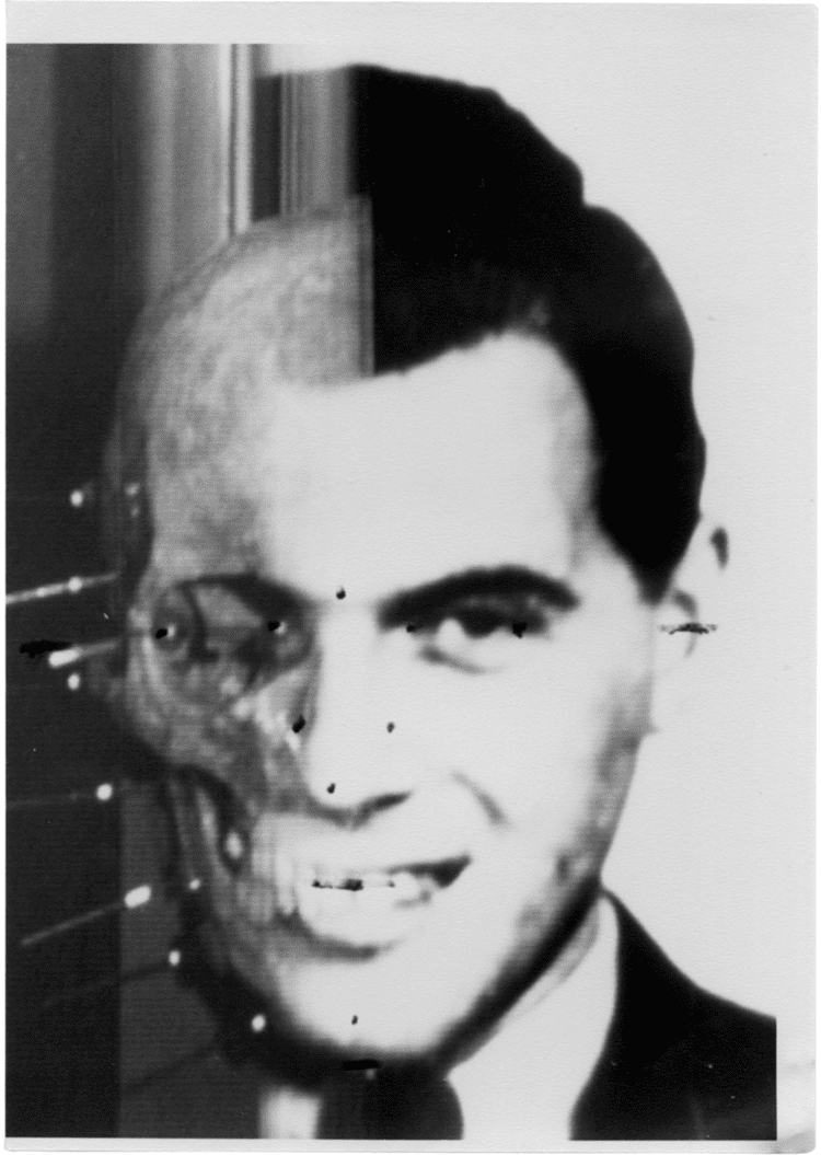 Josef Mengele The mystery of Josef Mengeles Brazilian skull Reunidas