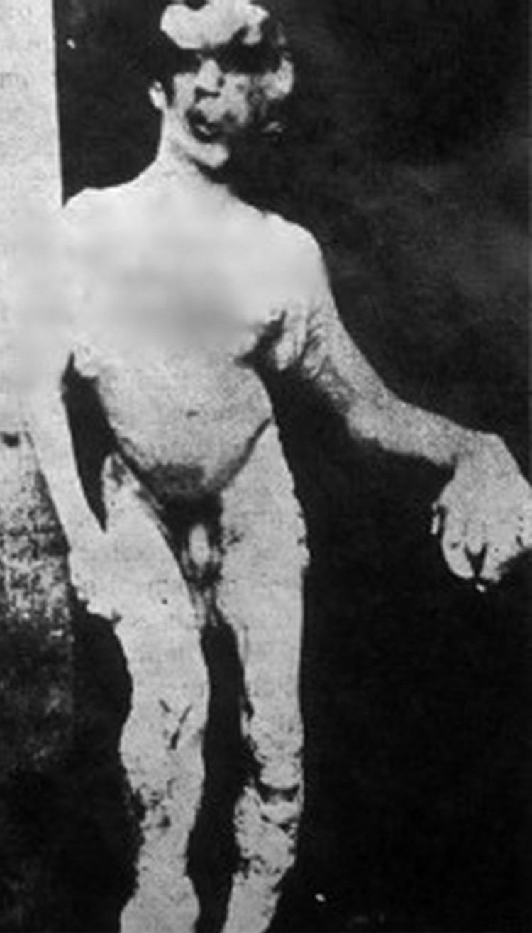 Joseph Merrick Dead Interesting Joseph Merrick The Elephant Man