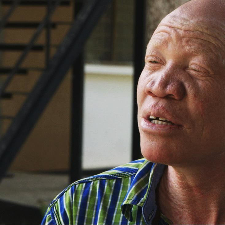 Josephat Torner Albino Activism in Tanzania VICE News Meets Josephat