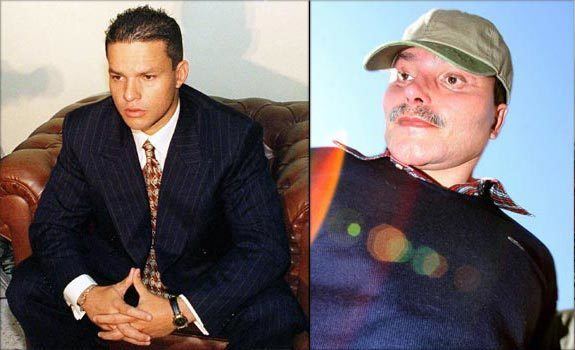 Juan Carlos Ramirez Abadia before and after surgery
