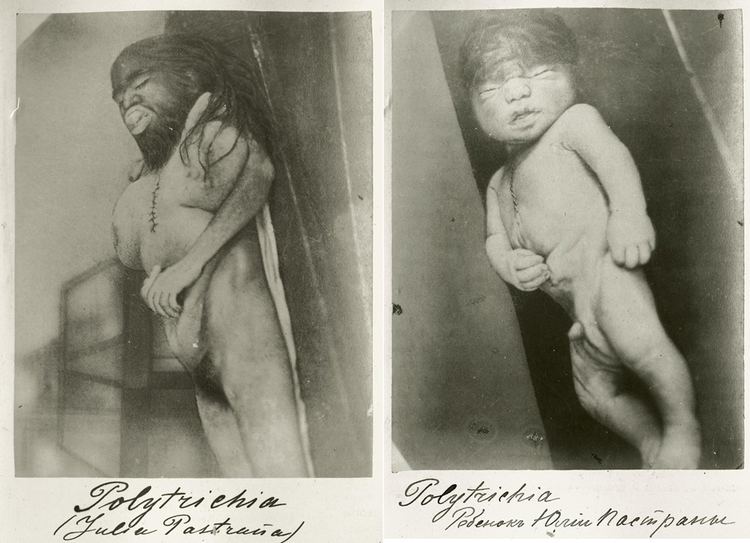 Julia Pastrana Behold The Heartbreaking HairRaising Tale Of Freak Show