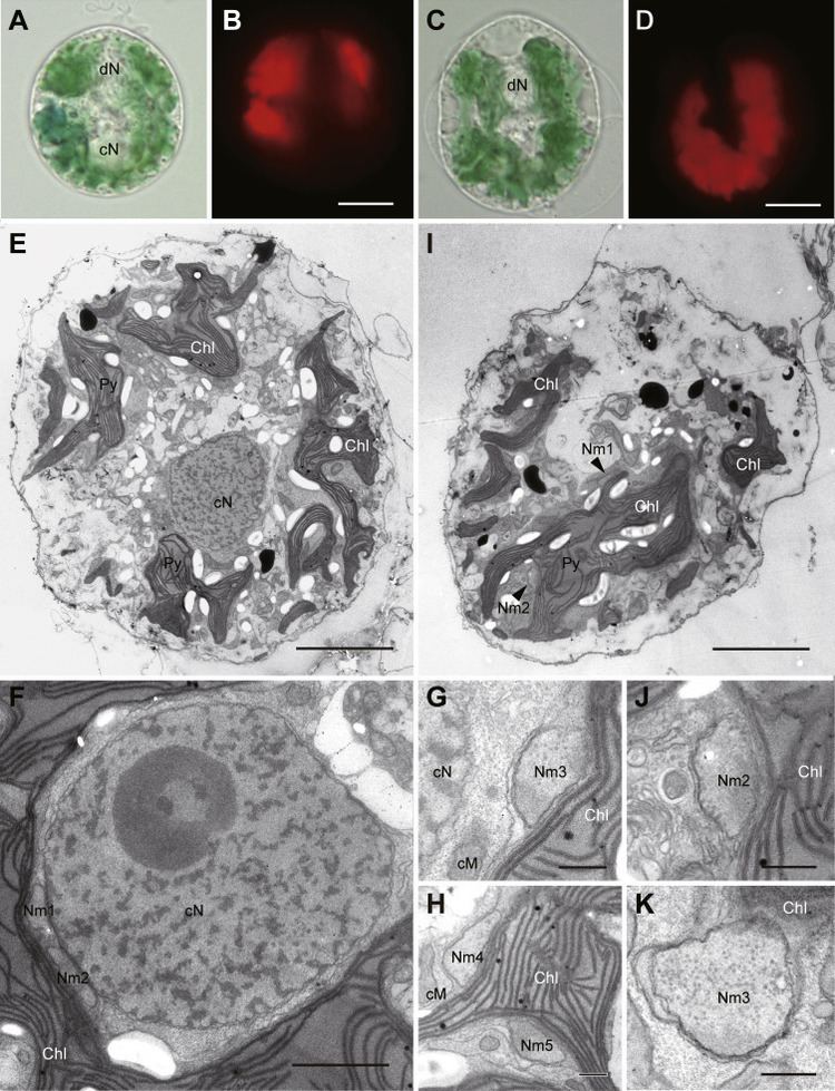 Kleptochloroplast Enlargement, Karyoklepty and the Distribution of the  Cryptomonad Nucleus in Nusuttodinium (= Gymnodinium) aeruginosum  (Dinophyceae) - ScienceDirect