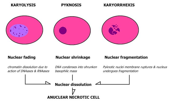 Karyolysis