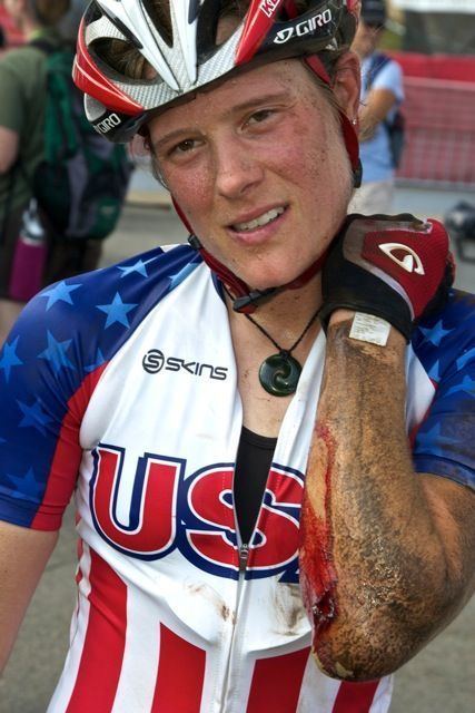 Katie Compton Injured Katie Compton Withdraws from CrossVegas and Planet