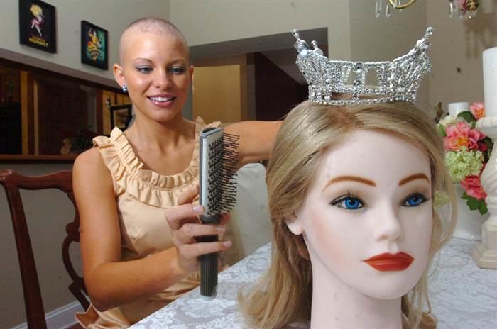 Kayla Martell Your new Miss America might be beautiful and bald TODAYcom