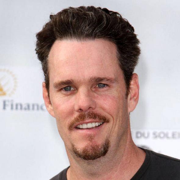 Kevin Dillon Kevin Dillon nursing broken wrist Celebrity News