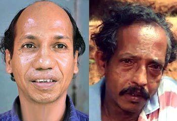 On the left, Krishnankutty Nair smiling, with a half-bald head, and wearing a blue polo shirt. On the right, Krishnankutty Nair with a sad face, with a mustache, and wearing a red and light blue polo shirt.