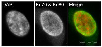 Ku70 AntiKu70 antibody S5C11 ab3108 Abcam
