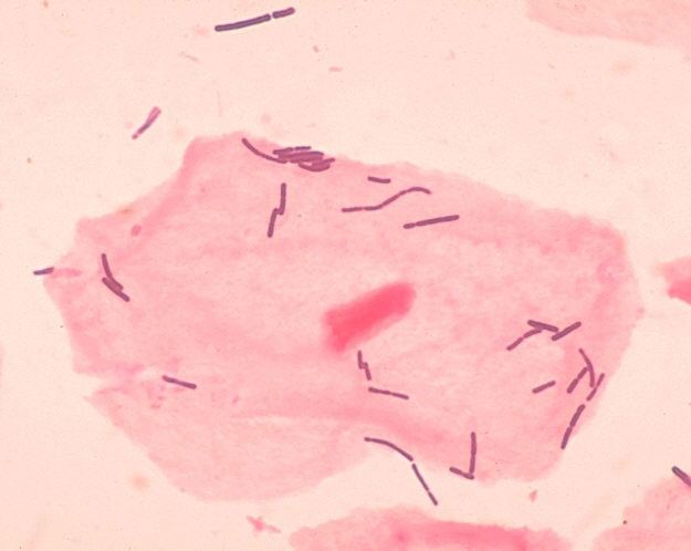 Lactobacillus httpsuploadwikimediaorgwikipediacommons77