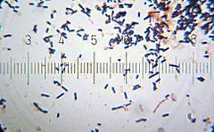 Lactobacillus acidophilus Lactobacillus acidophilus Wikipedia