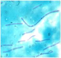 Lactobacillus bulgaricus GLB44 httpsuploadwikimediaorgwikipediaen66bMic
