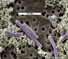 Lactobacillus casei genomejgidoegovlaccalaccajpg
